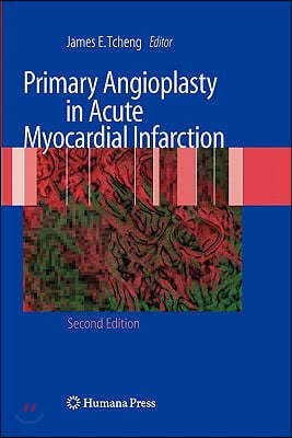 Primary Angioplasty in Acute Myocardial Infarction