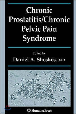 Chronic Prostatitis/Chronic Pelvic Pain Syndrome