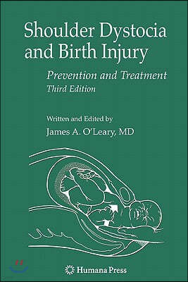 Shoulder Dystocia and Birth Injury: Prevention and Treatment