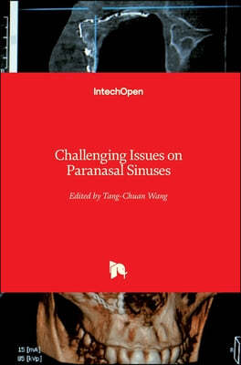 Challenging Issues on Paranasal Sinuses