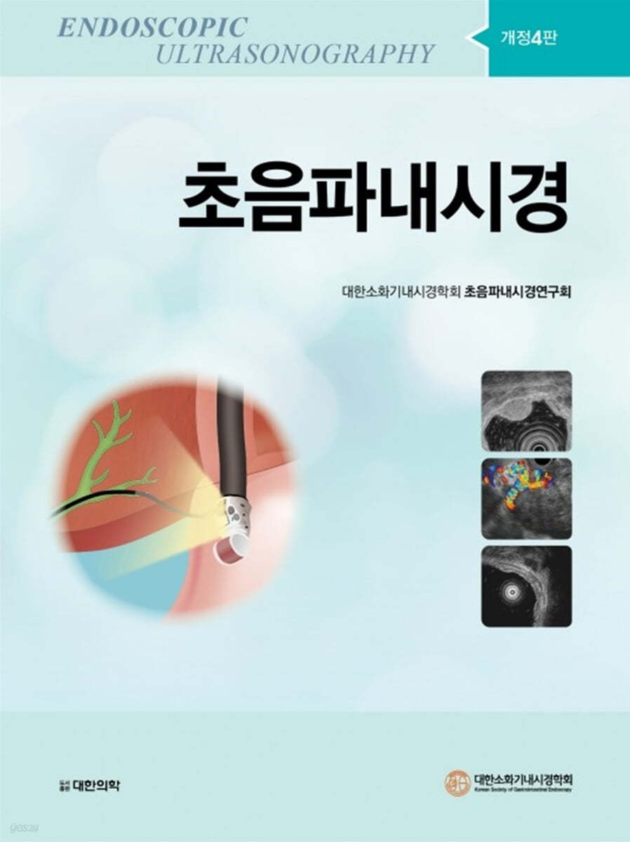 초음파내시경