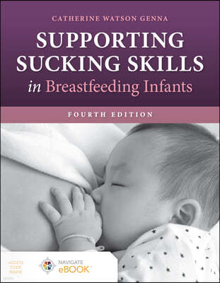 Supporting Sucking Skills in Breastfeeding Infants