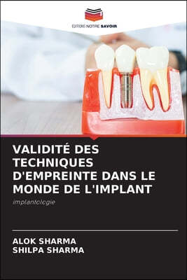 Validite Des Techniques d'Empreinte Dans Le Monde de l'Implant