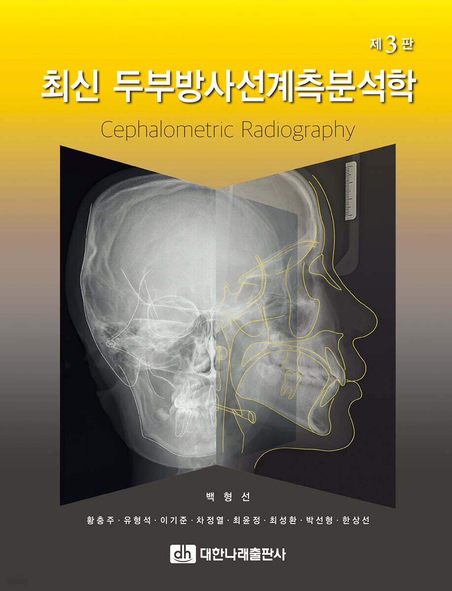 최신 두부방사선계측분석학