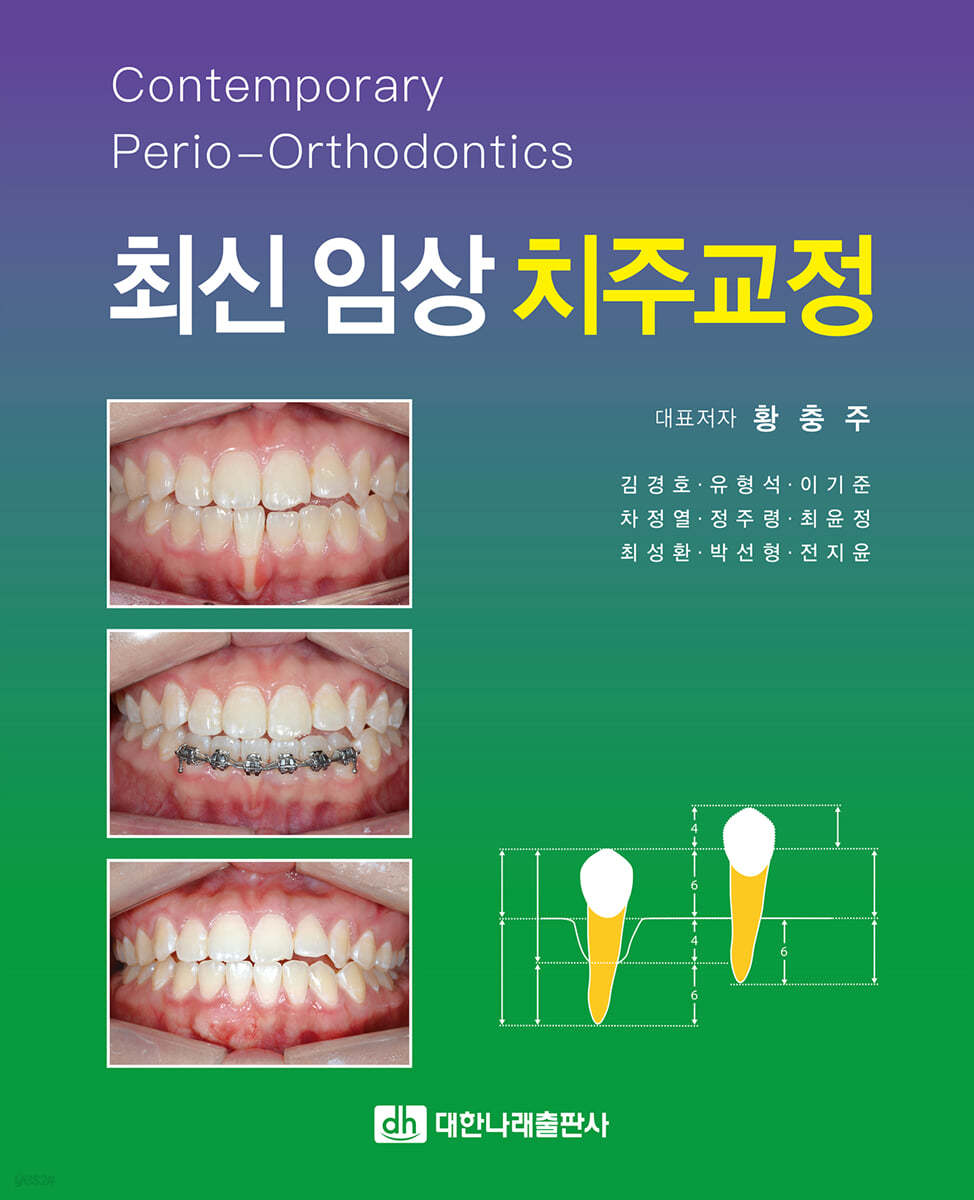 최신 임상 치주교정