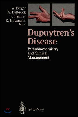 Dupuytren's Disease: Pathobiochemistry and Clinical Management