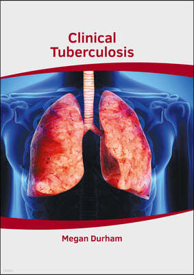 Clinical Tuberculosis