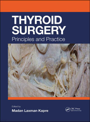 Thyroid Surgery