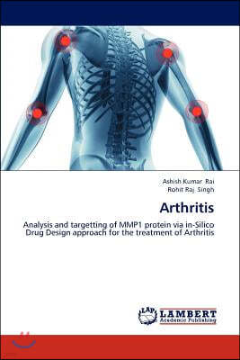 Arthritis