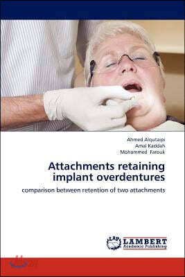 Attachments retaining implant overdentures