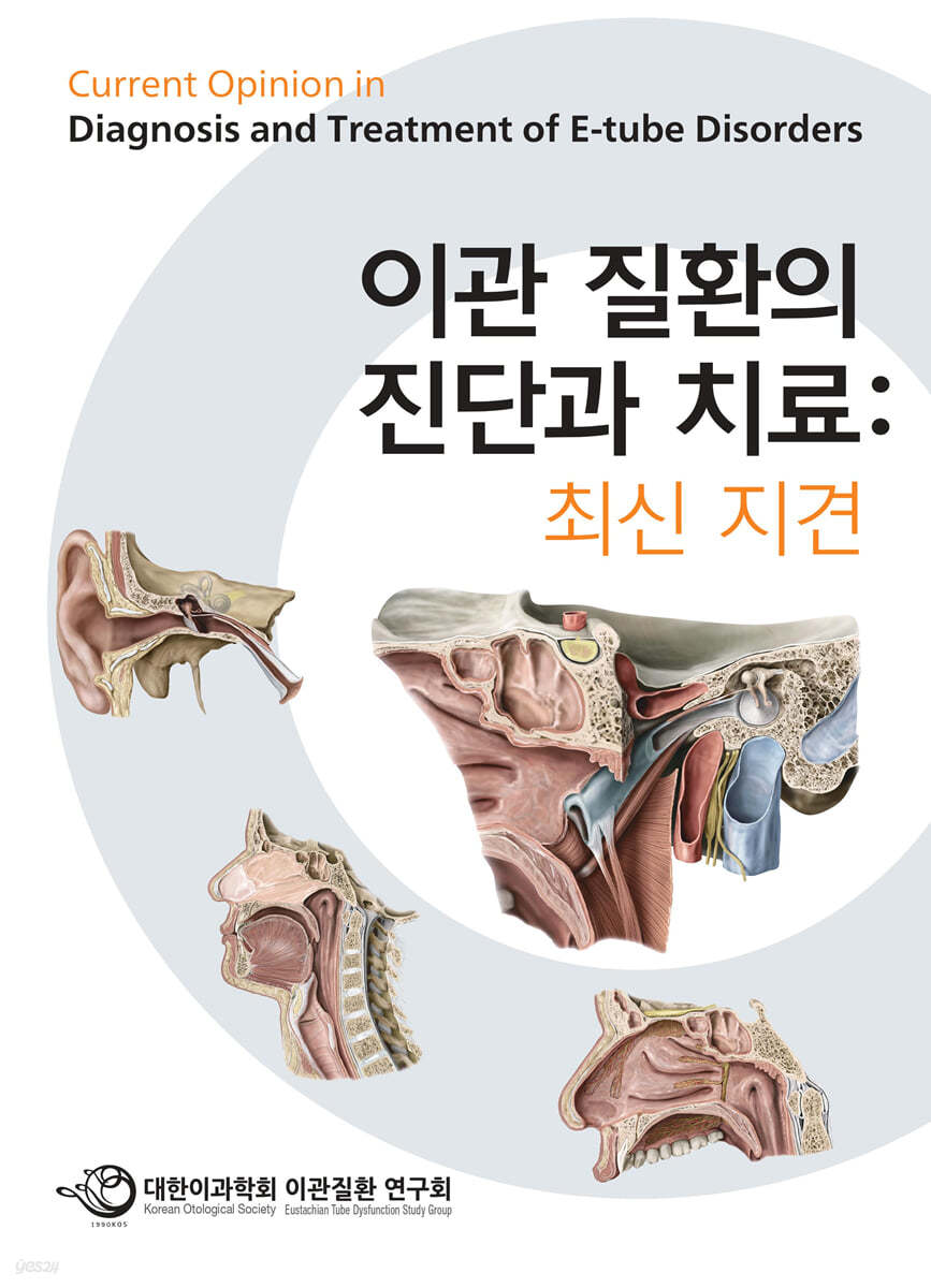 이관 질환의 진단과 치료 : 최신 지견