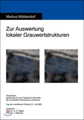 Zur Auswertung lokaler Grauwertstrukturen