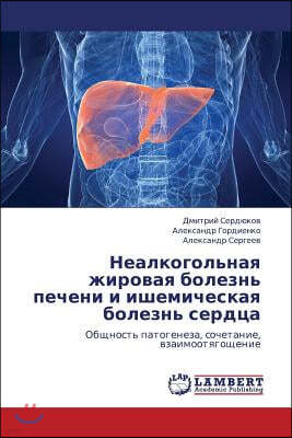 Nealkogol'naya Zhirovaya Bolezn' Pecheni I Ishemicheskaya Bolezn' Serdtsa