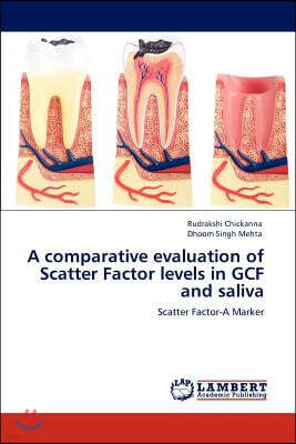 A Comparative Evaluation of Scatter Factor Levels in Gcf and Saliva