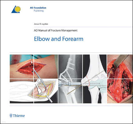 AO Manual of Fracture Management - Elbow & Forearm