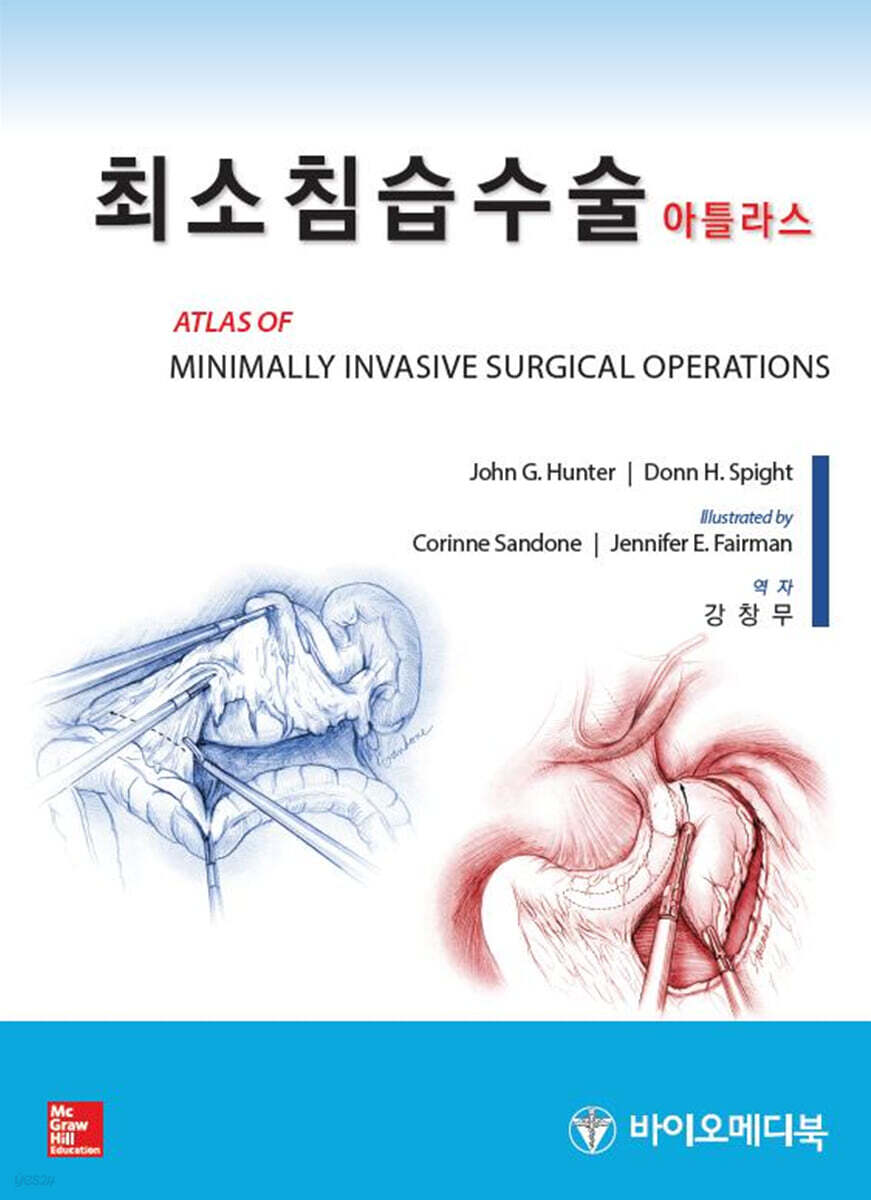 최소침습수술 아틀라스 (MIS)