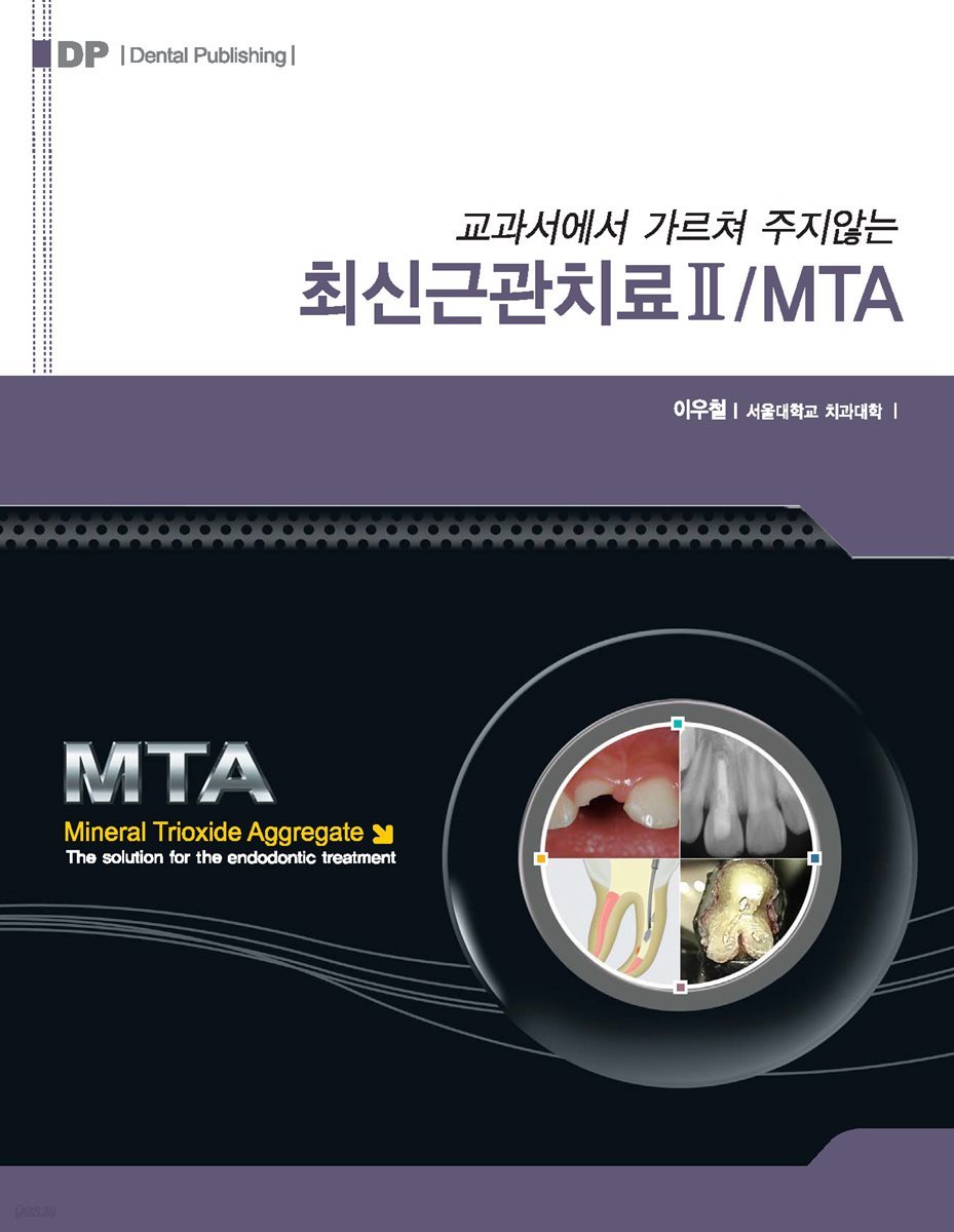 교과서에서 가르쳐 주지 않는 최신근관치료 Ⅱ/MTA