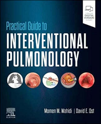 Practical Guide to Interventional Pulmonology