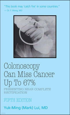 Colonoscopy: Can Miss Cancer Up to 67%_Presenting Near Complete Rectification