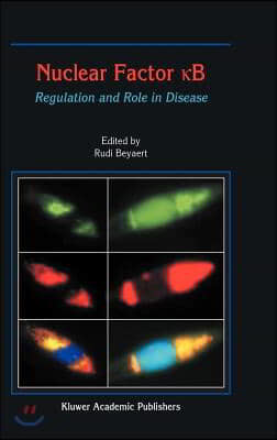 Nuclear Factor &#1082;b: Regulation and Role in Disease