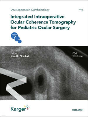 Integrated Intraoperative Ocular Coherence Tomography for Pediatric Ocular Surgery