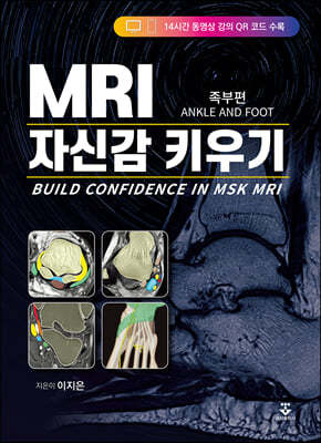 MRI ڽŰ Ű 