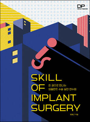 SKILL OF IMPLANT SURGERY