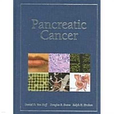 Pancreatic Cancer (Hardcover)  