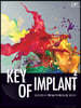 Key of Implant 2