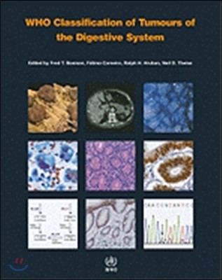 WHO Classification of Tumours of the Digestive System