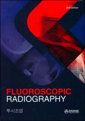 (Fluoroscopic Radiolography) 
