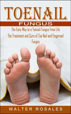Toenail Fungus: The Easy Way to a Toenail Fungus-free Life (The Treatment and Cure of Toe Nail and Fingernail Fungus)