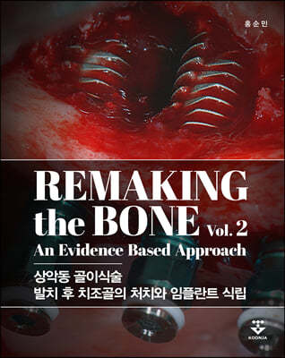 Remaking the Bone Vol.2 (ǵ ̽ļ, ġ  ġ óġ öƮ ĸ)