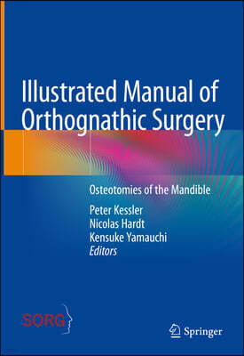 A Illustrated Manual of Orthognathic Surgery