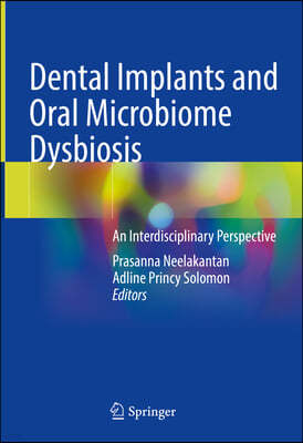 Dental Implants and Oral Microbiome Dysbiosis: An Interdisciplinary Perspective