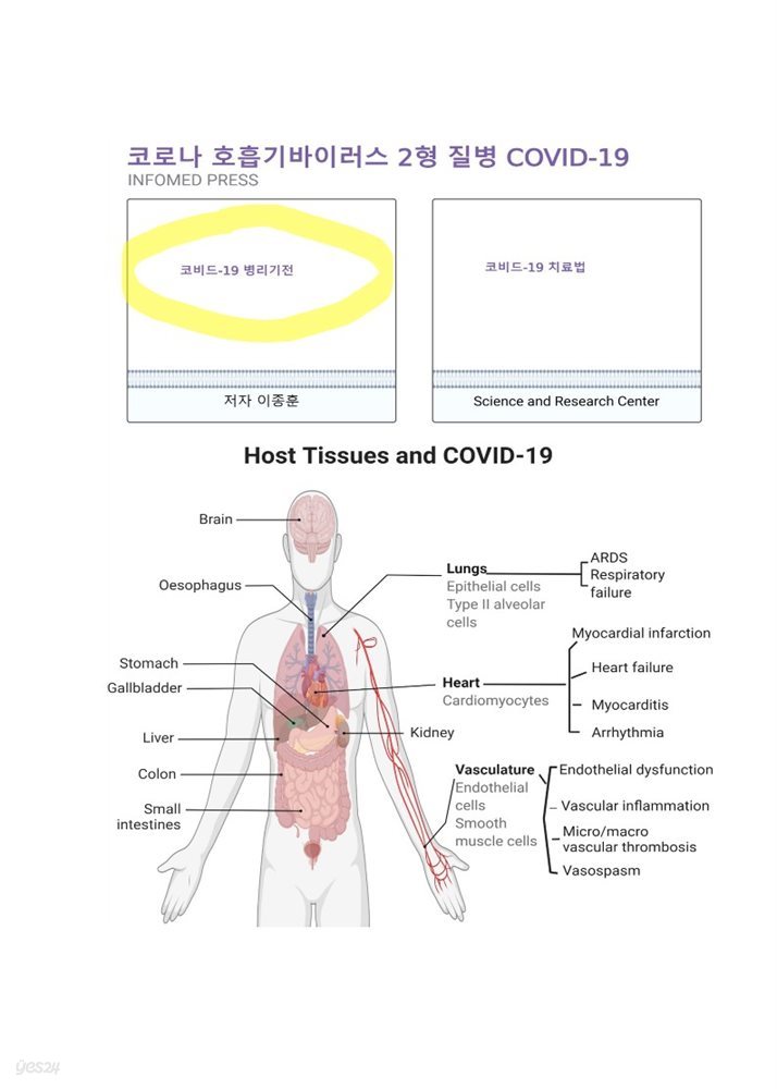 코로나 호흡기바이러스 2형 질병 (COVID-19) 병리 기전