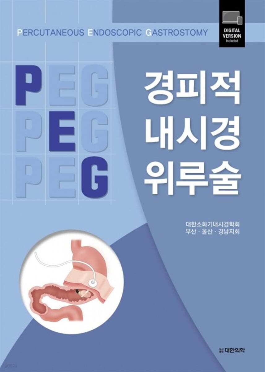 경피적내시경위루술