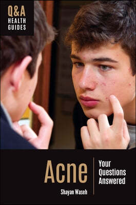 Acne: Your Questions Answered