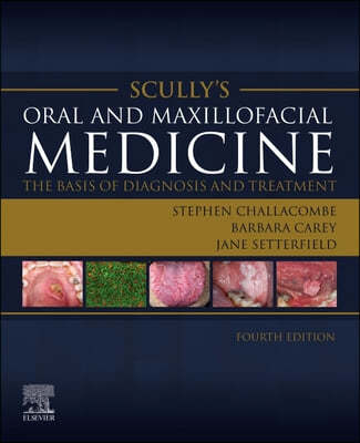 Scully's Oral and Maxillofacial Medicine: The Basis of Diagnosis and Treatment: The Basis of Diagnosis and Treatment