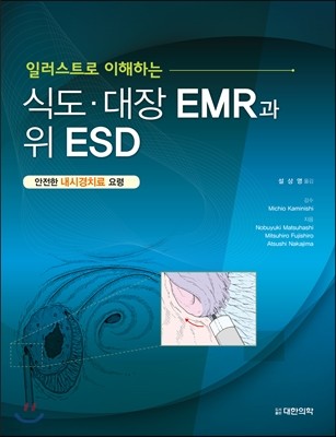 식도·대장 EMR과 위