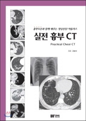 실전 흉부 CT 흉부X선과 함께 배우는 영상진단 아틀라스