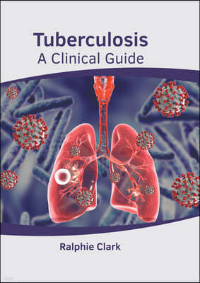 Tuberculosis: A Clinical Guide
