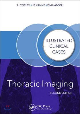 Thoracic Imaging