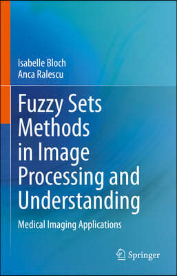 Fuzzy Sets Methods in Image Processing and Understanding: Medical Imaging Applications