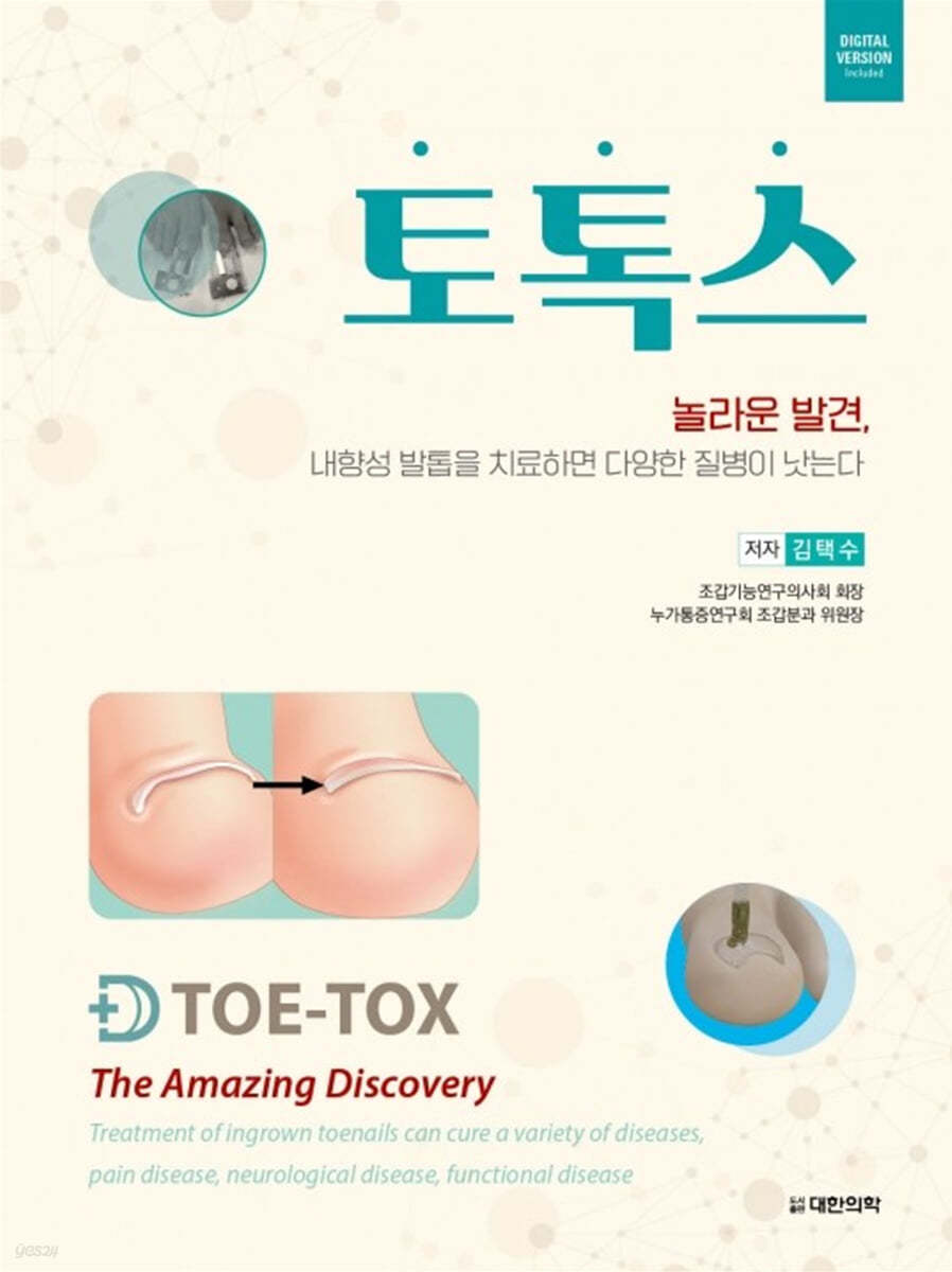 토톡스 TOE-TOX