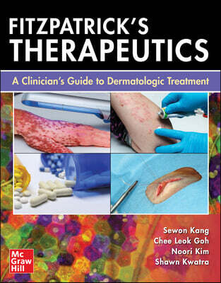 McGraw Hill / Medical Fitzpatrick's Therapeutics: A Clinician's Guide to Dermatologic Treatment