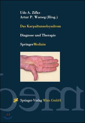 Das Karpaltunnelsyndrom: Diagnose Und Therapie