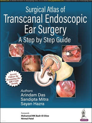 Surgical Atlas of Transcanal Endoscopic Ear Surgery