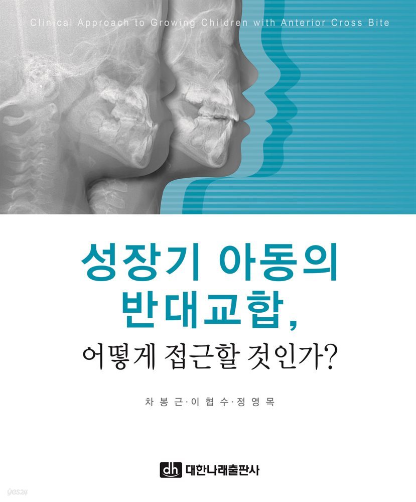 성장기 아동의 반대교합, 어떻게 접근할 것인가?