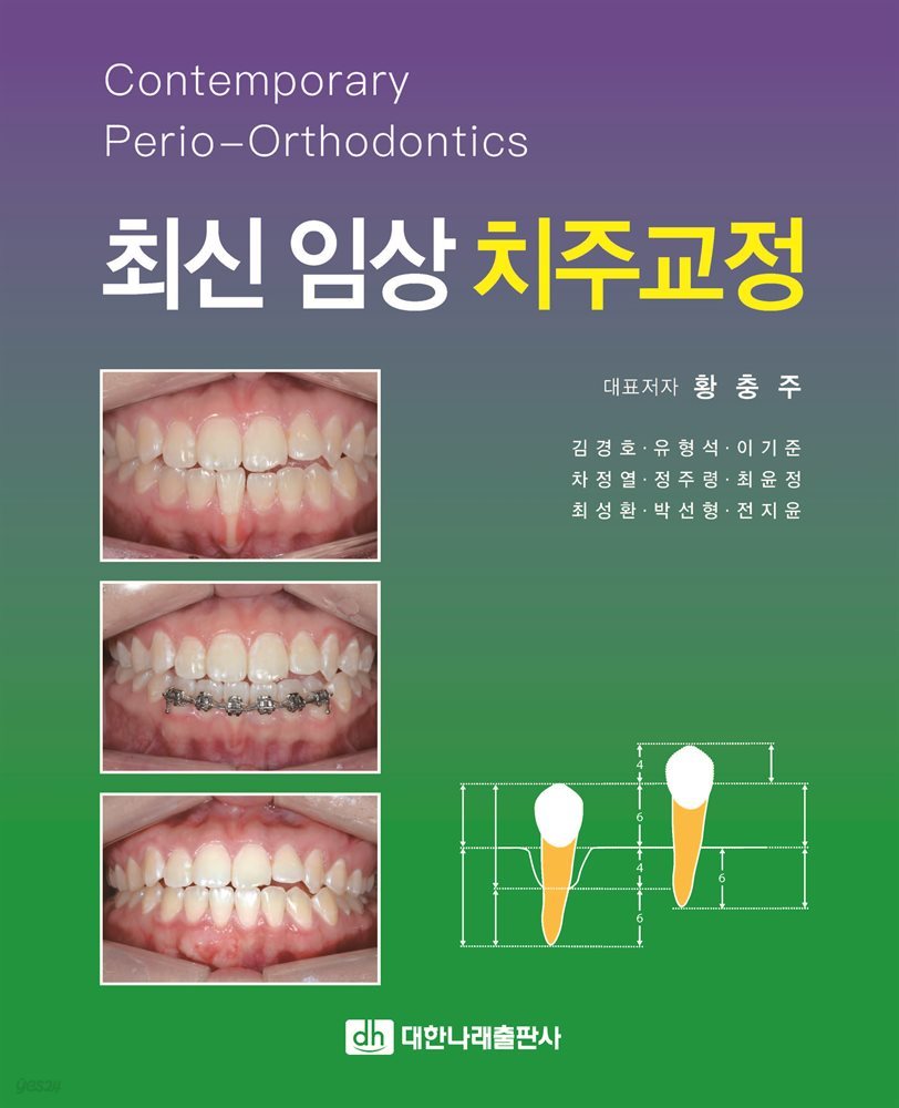 최신 임상 치주교정